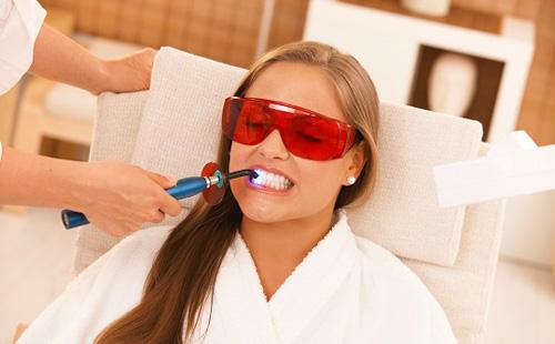 Laser Teeth Whitening